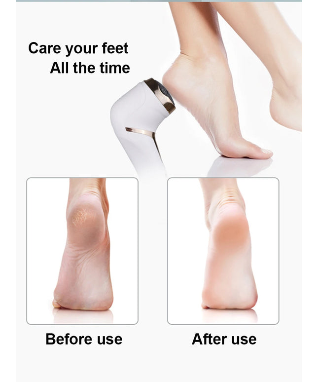 Electric Foot Polisher Callus Remover